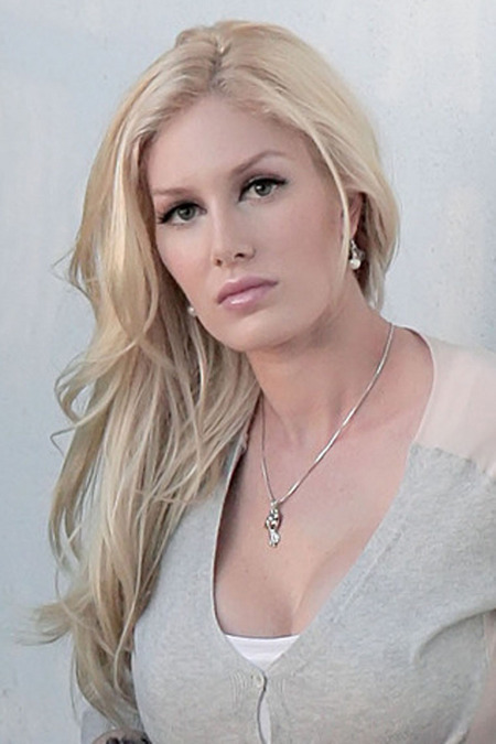 heidi montag after surgery photos. A close up of Heidi Montag#39;s