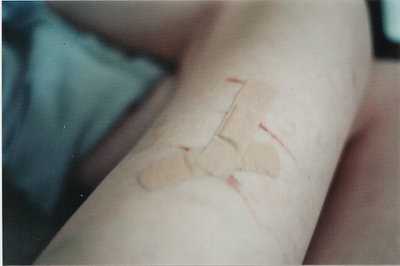 A impressão que tenho é que nunca vai passar. Que a cicatriz não fecha. Que só de esbarrar, sangra.