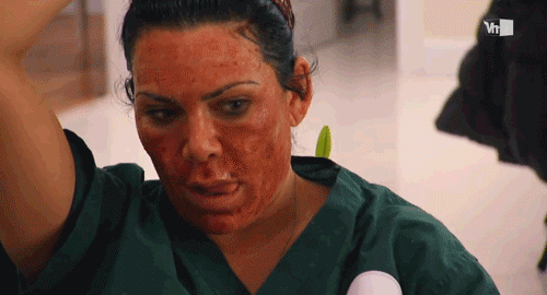 mob wives renee graziano chemical peel. Mob Wives finale