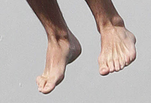  directioners 1D one direction six toes 12 nipples harry styles louis 