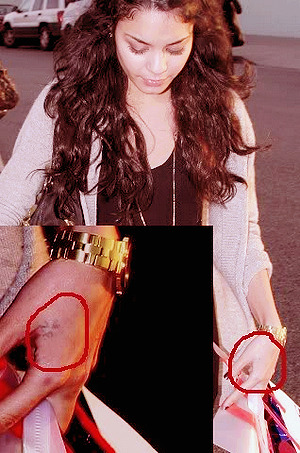 Her hand says&#8221;♥Z.E&#8221;.